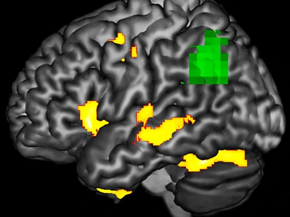 brain